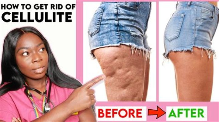 Camila Cabello: ‘Girls, cellulite is normal, fat is normal, it’s beautiful & natural’