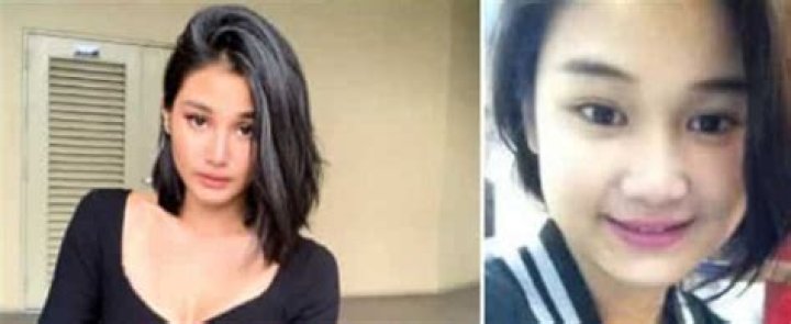 Chie Filomeno Plastic Surgery – Before And After Pics And Health