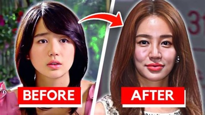 Choi Min-Young Plastic Surgery: Before And After Photos