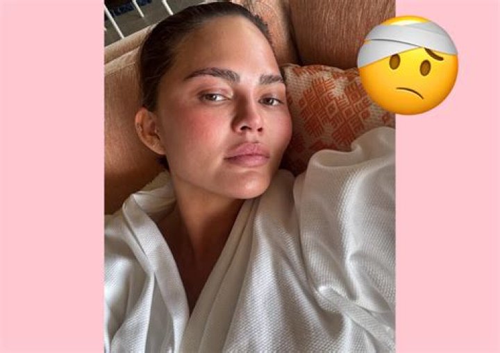 Chrissy Teigen Shocks Fans with New Plastic Surgery