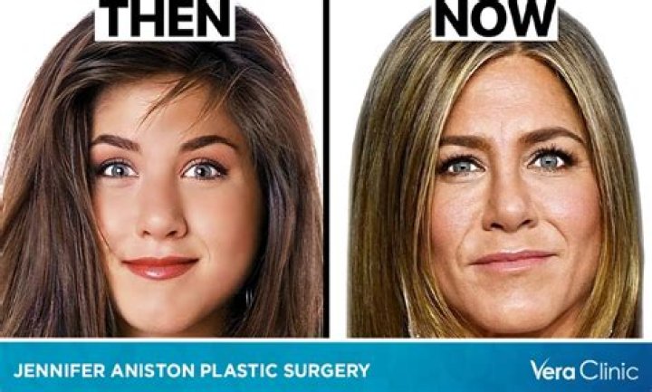 Jennifer Jason Leigh Botox And Nose Job – Plastic Surgery Before And After