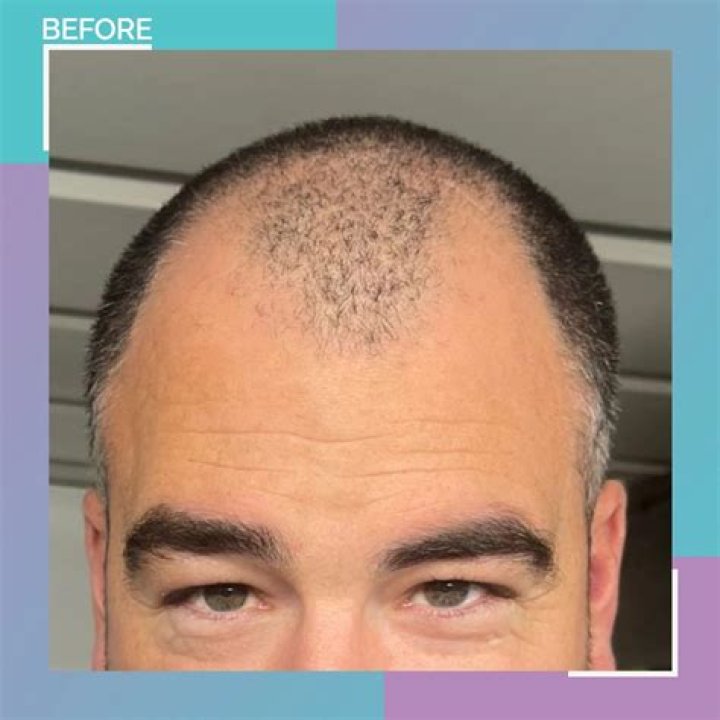 Jude Law is finally owning his receding hairline/baldness: sexy or busted?