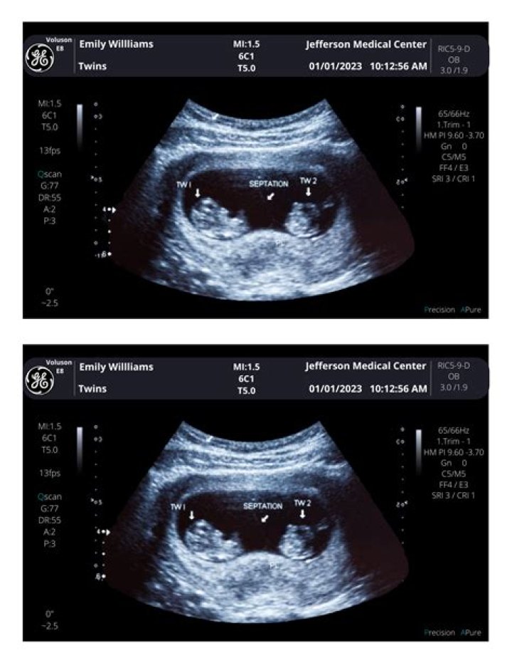 JWoww Shares Sonogram Picture, Says Baby is “So Dramatic Already”