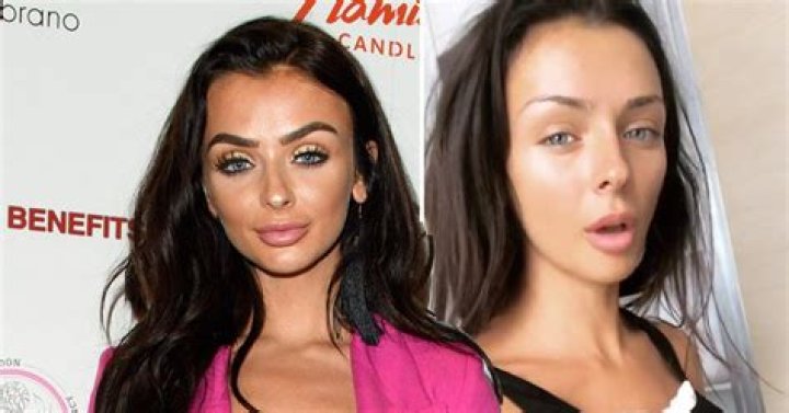 Kady Mcdermott Surgery: Did She Get Boobs Job Done? Before And After Pics