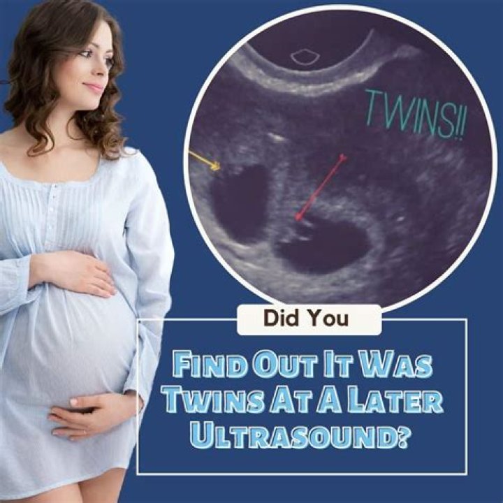 Leah Messer's Sister Shares New Ultrasound Of Twins!