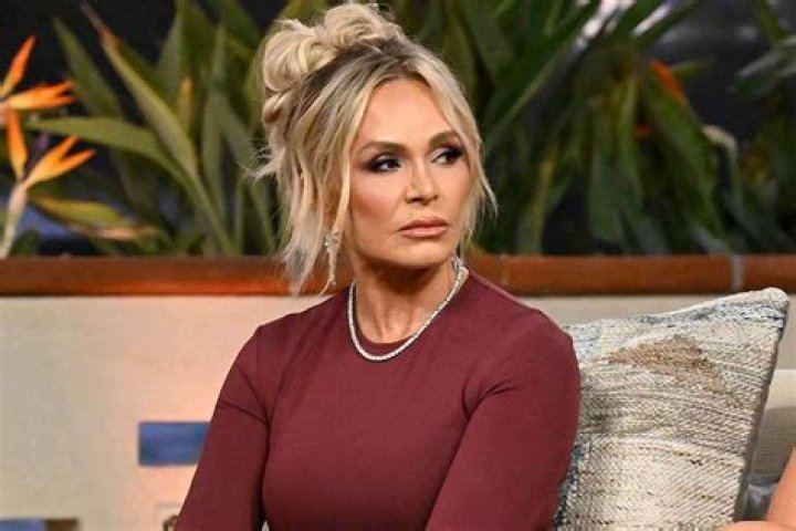 Tamra Judge Gets Real About Having Work Done